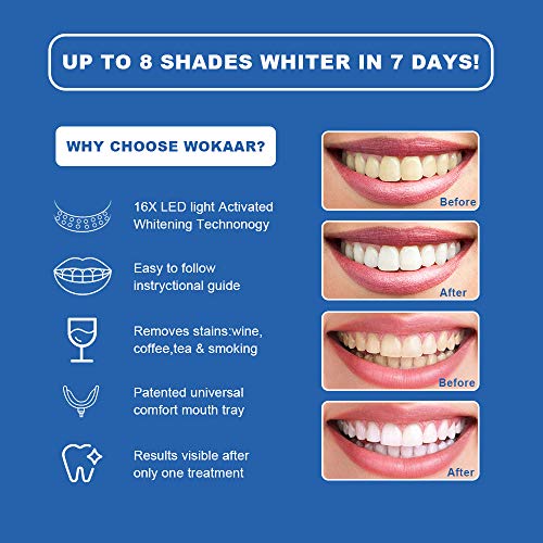 Teeth Whitening Kit Professional, Teeth Whitening Strips, NonSensitive