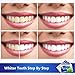 Teeth Whitening Strips, MayBeau 56Pcs Teeth Whitening Kit, Peroxide-Free 3D Whitestrips No Sensitivity Home Tooth Bleaching for Tooth Whitening 28 Days Treatment