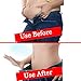 Trendyline Women Postpartum Girdle Corset Recovery Belly Band Wrap Belt,Large,Beige Nude Large