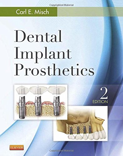 Download Dental Implant Prosthetics, 2e Download Dental Implant Prosthetics, 2e