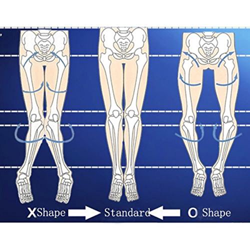 BININBOX O Leg /X Bowed Legs Correction Band Legs Straigh ten Belt Everyday Wear 3 Pcs Set (M) - Thumbnail 3