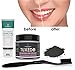 Teeth-Whitening Kit, Activated Charcoal Tooth Powder, Toothpaste, and Toothbrush