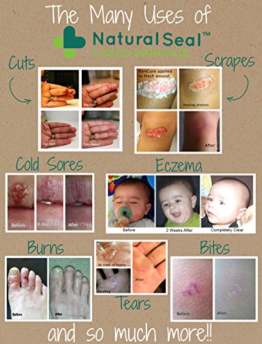 KeriCure's Natural Seal Spray on Liquid Bandage, 1oz Spray Barrier, Pack of 4, Made in The USA, Woman owned small business - Thumbnail 6