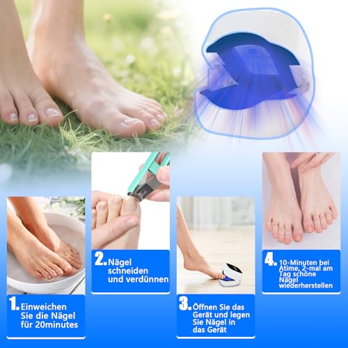 Laser Nail Fungus Fast Action High Efficiency - Cold Laser Therapy Treatment of Multiple Blue Comfortable Toes and Feet Infrared Therapy - Laser Nail Fungus
