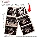 Prank Ultrasound | Custom Positive Pregnancy Ultrasound 3 Image Strip with Your Custom INFO (Printed ON Real Ultrasound Paper) Novelty Gag Prank