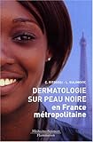 Image de dermatologie sur peau noire en france metropolitaine