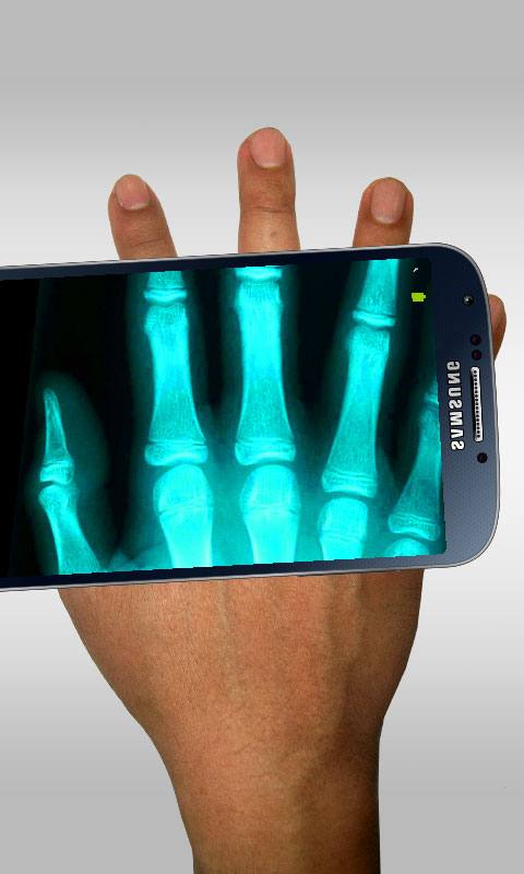 Amazon Com Xray Scanner Hd Appstore For Android Amazon Com Xray Scanner Hd Appstore For Android