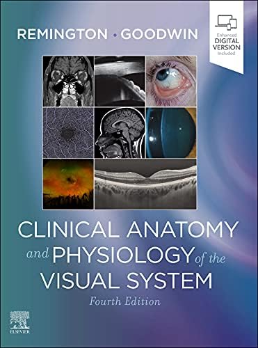 Amazon.com: Clinical Management of Binocular Vision eBook
