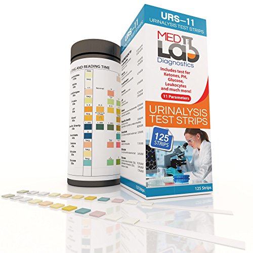 Thing need consider when find urinalysis kidney test strips?