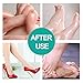 Foot Peel Mask Feet Baby Soft Touch 2 Pack- Phenitech Exfoliating Dead skin Foot Peeling Mask and Callus Reducer Away