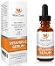 Vitamin C Serum For Face and Skin with 20% Vitamin C + E + Hyaluronic Acid - Our #1 BEST Serum to Fade Sun Spots & Discoloration - Rejuvenates & Brightens Skin - Guaranteed Glow! - 1oz (30ml)
