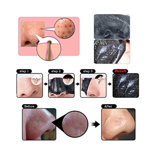 Sunward Face Care Suction Black Mask Facial Nose Blackhead Remover Peeling Peel Off Acne Treatments Better