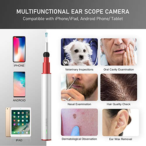 BEBIRD Ear Wax Removal, Ears Cleaner, Earwax Remover Tool with 1080P