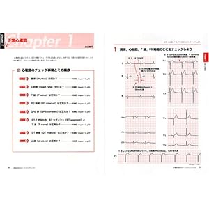 The Perfect Manual How to Decipher an Electrocardiogram (In Japanese) (The Complete Training with Theorys and Waveform Patterns)