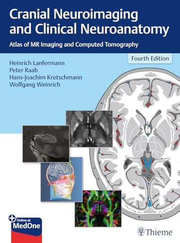 Decision Making in Neurovascular Disease: 9781684200573: Medicine
