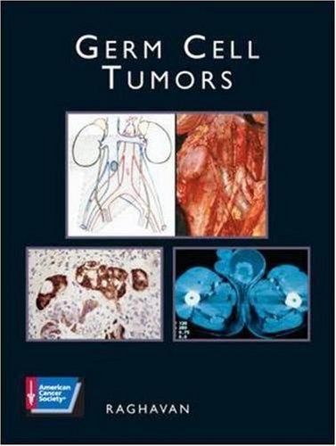 GERM CELL TUMORS