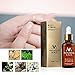 Ochine 30ML Fungal Treatment Essence Onychomycosis Fungal Remover Nail Feet Care Serum