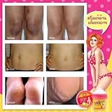 NEW- CREAM-OHO SOFT GLUTA WHITE Remove dead skin cells OHO Clear dark whiteing