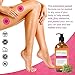 Anti Cellulite Treatment Massage Oil - Doctor Formulated Therapeutic Grade - 100% All-Natural Ingredients with 8 Essential Oils - Breaks Down Unwanted Fat Tissue - 8 oz by Dr. Inna