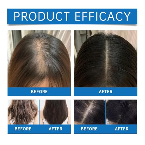 LBOYLOVE® Hair Wise Rosemary Hair Growth Serum with Redensyl and Anagain, Roll-On Boosts Oxygen Flow, Reduces Hair Fall 25ml For All Hair Types