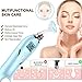 Sovob Blackhead Remover Vacuum Pore Cleaner Electric Blackhead Removal Acne Comedone Extractor Tool with Hot/Cold Care LED Display USB Rechargeable 5 Adjustable Suction Power 5 Probes… (Blue)