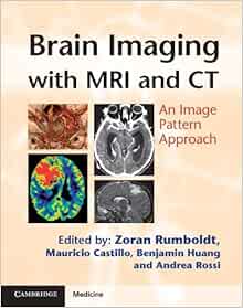 Brain Imaging with MRI and CT: An Image Pattern Approach: 9780521119443 ...
