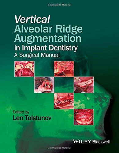 Vertical Alveolar Ridge Augmentation in Implant Dentistry: A Surgical Manual