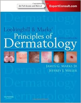 Lookingbill And Marks Principles Of Dermatology 5e