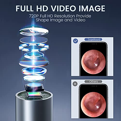 ScopeAround Otoscope with Ear Wax Removal Tool, 3.9mm UltraThin WiFi