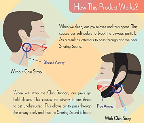 Anti Snoring Chin Strap | Best Snoring Solution and Anti Snoring Devices | Snoring Chin Strap | Snore Stopper | Stop Snoring Sleep Aid for Men and Women | 4 Nose Vents Free | Snore Chin Strap (Black) - Thumbnail 6