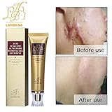 2PCS TCM Scar Cream, Acne Scar Removal Cream, Skin Repair Scars Burns Cuts Pregnancy Stretch Marks, Acne Spots Acne Treatment Blackhead Whitening Cream Stretch Marks for Face and Body (30ml)