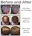 Thicken It 100% Scalp Coverage Hair Powder - MEDIUM BROWN - Talc-Free .32 oz. Water Resistant Hair Loss Concealer for men and women. Naturally Thicker Than Hair Fibers & Spray Concealers