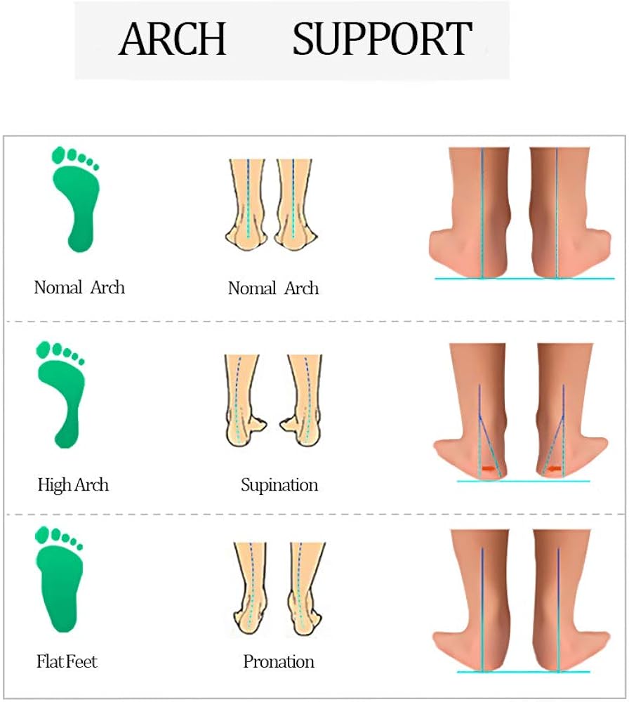 supination and flat feet