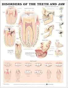 Disorders Of The Teeth And Jaw Anatomical Chart (9781587792502)