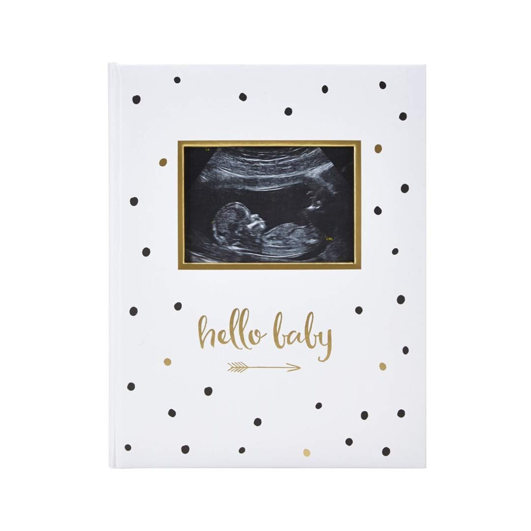 Pearhead First 5 Years Baby Memory Book with Sonogram Photo Insert, Black and Gold Polka Dot, Baby Keepsake Memory Book, Hello Baby Babybook