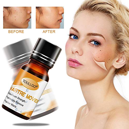 Plantar Wart Remover, Wart Removal, Salicylic Acid Wart Removal