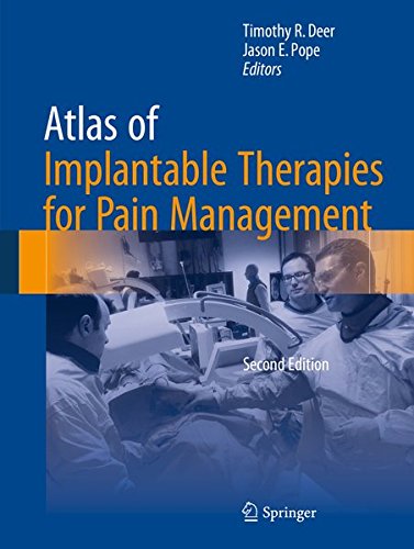 Download Atlas of Implantable Therapies for Pain Management Download Atlas of Implantable Therapies for Pain Management