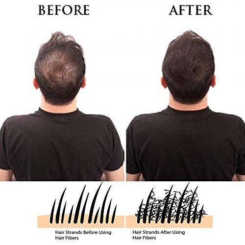 IMMETEE Keratin Hair Building Fibers Powder Conceal Instantly for Thinning Hair,Cover Up Hair Loss Natural Thickens for Men and Women-25g/0.88oz (GRAY)
