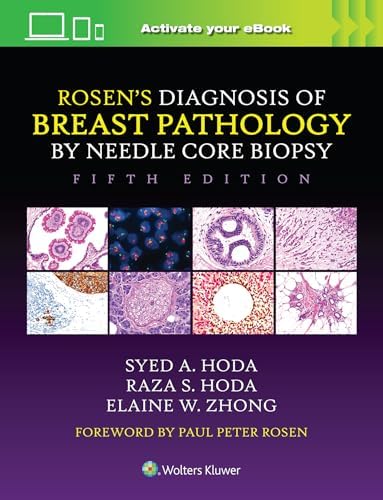 Rosen's Breast Pathology: 9781496398918: Medicine & Health Science