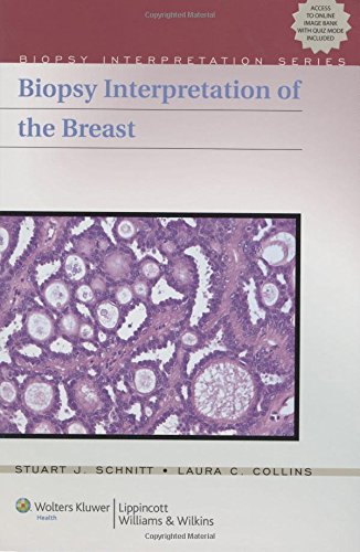 Biopsy Interpretation Of The Breast (Biopsy Interpretation Series)