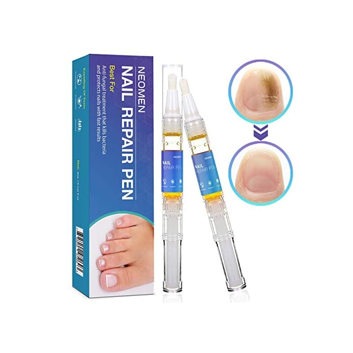 Nail Fungus Treatment Pen, Nail Fungus Treatment for Toenail Pen, Toenail and Nail Care, Nail Support by Neomen (4 Pcs…