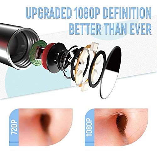 Ear Otoscope Camera Wireless Ear Scope 1080P WiFi Ear Endoscope for Earwax Removal with 6 LEDs, 3-Axis Gyroscope and Temperature Control, Compatible with Android iOS Smartphone and Tablet