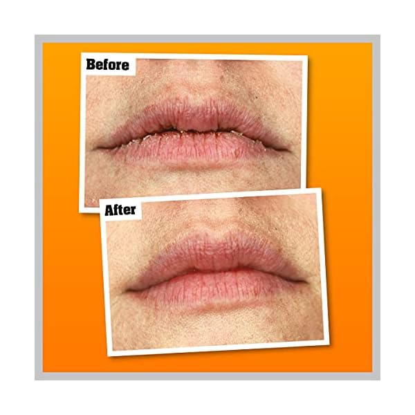 OKeeffes-Lip-Repair-Overnight-7-g-Opaque O'Keeffe's Lip Repair Overnight 7g