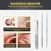 Blackhead Remover Tweezer Kit, ElleSye 6-PCS Pimple Comedone Extractor, Blackhead Whitehead Blemish Acne Zit Removal Tool for Risk Free Nose Face-Silver