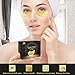 Under Eye Patches, POPPYO 24K Gold Eye Treatment Mask, Collagen Eye Mask, with Anti-aging and Wrinkle Care Properties, Reducing Dark Circles Puffiness Undereye Bags(30 Pairs)