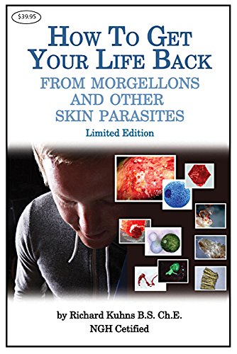 How to Get Your Life Back From Chronic Lyme, Morgellons and Other Skin Parasites