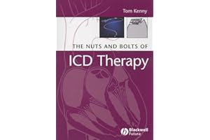 The Nuts and Bolts of ICD Therapy