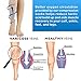 Compression Socks 20-30mmHg Open Toe with Free Removable Satin Sock Professional Care for Ankle,Varicose Veins, Calf Edema Pain Relief Suitable for Nurses Maternity Flight Travel Men Women XL