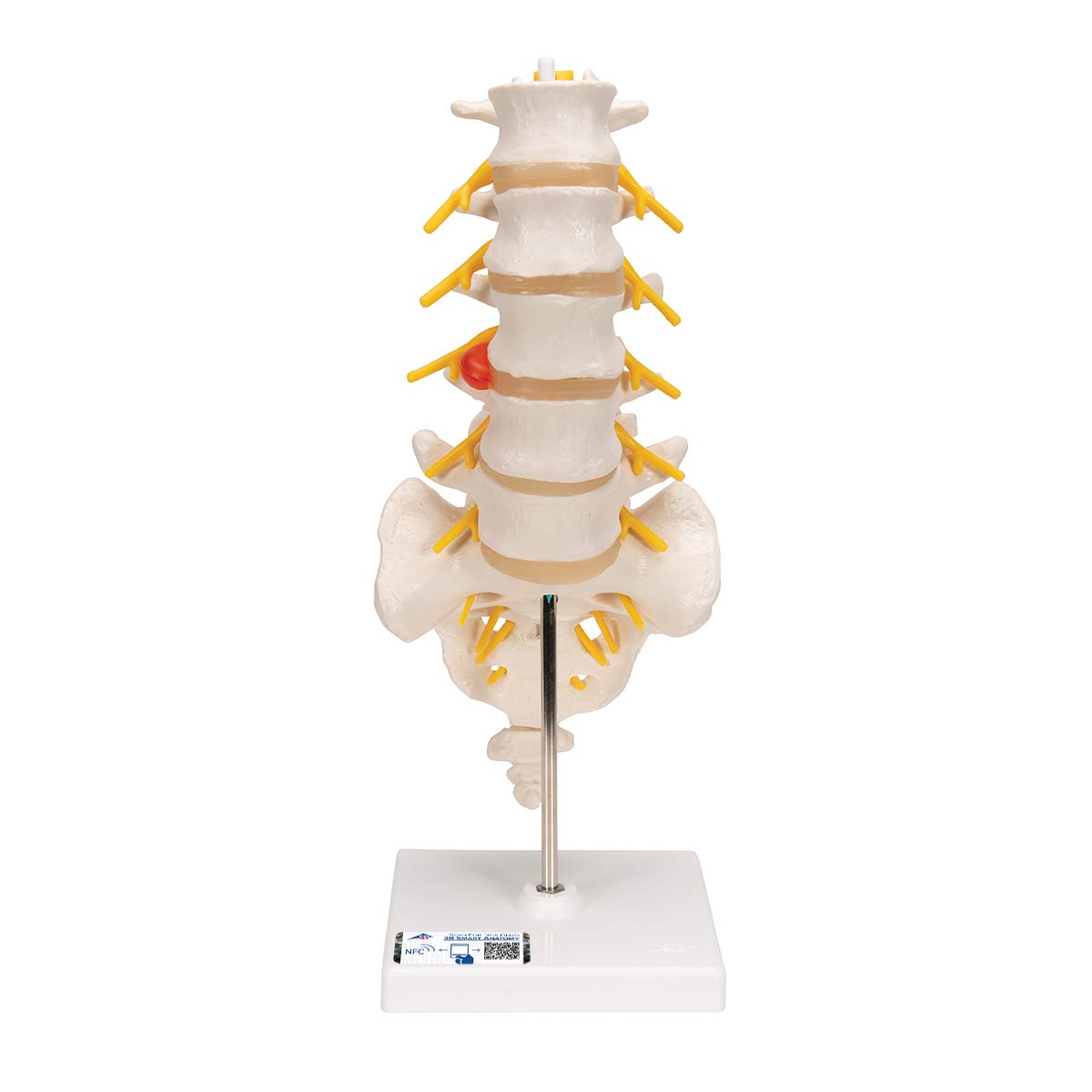 3B Scientific Lumbar Spinal Column with Dorso Lateral Prolapsed InterVertebral Disc + free anatomy software - 3B Smart Anatomy