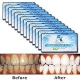 Teeth Whitening Strips - Glamorous White - 6% HP Professional Strength - 30 Mins Express Effect - 14 Packs 28 Pieces + Bonus Shade Guide - Vakker